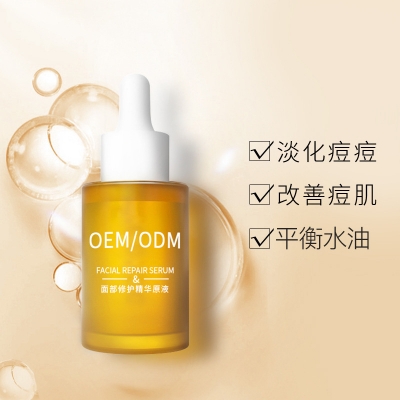 宁波市_祛痘精华原液OEM